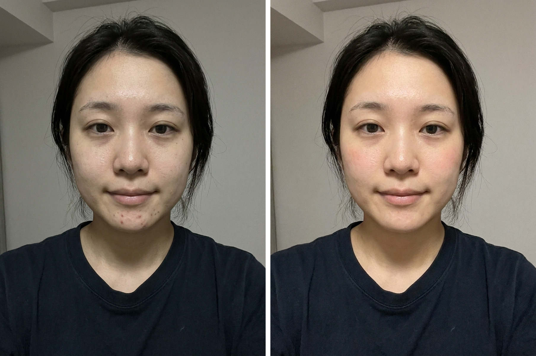 AIで自撮りを自然に盛ったビフォーアフターの例。左が加工前、右が自然に盛った後で、肌が明るく整っているが目や輪郭の大きさは変えていない